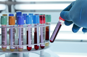 blood labs
