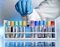 lab tests